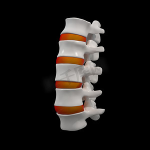 腰椎疼痛摄影照片_与红色椎间盘的背景
