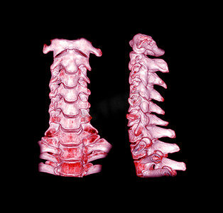 颈椎简笔画摄影照片_颈椎 3D 渲染的 CT 扫描。