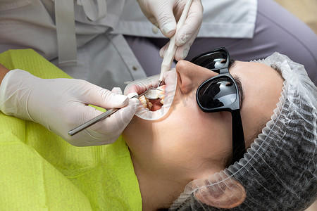 牙医在诊所用牙镜检查病人的口腔