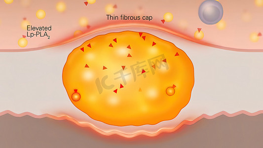 脂肪细胞和巨噬细胞，脂肪细胞领域，脂肪细胞的高质量 3D 渲染，细胞中的胆固醇