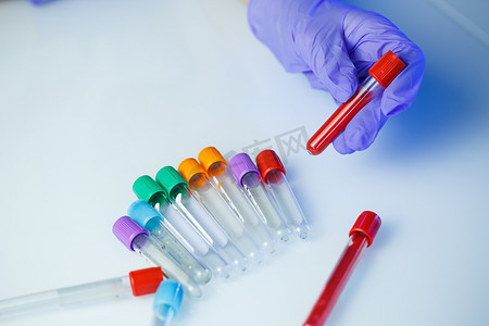 医疗专业人员、实验室助理、医生在实验室进行分析，使用试管、移液器和培养皿来检测人体内细菌的存在。