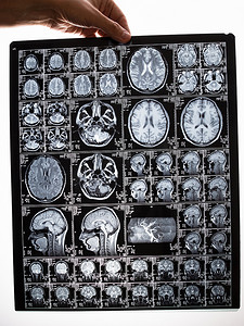 大脑 MRI 扫描图像。