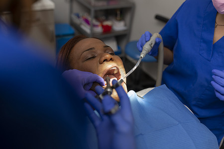 一位黑人女病人在接受牙医治疗时张着嘴