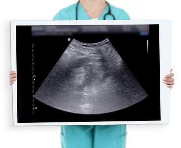 选择性聚焦女医生为新妈妈展示超声图像。