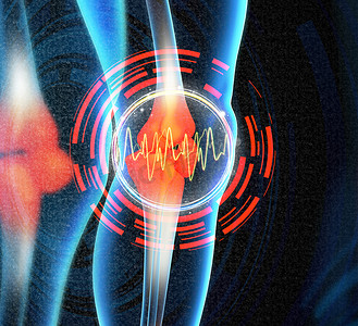 人类膝盖疼痛与骨骼腿的解剖