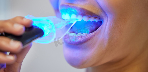 最快、最安全的牙齿美白方法。