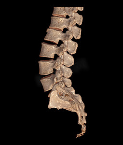 CT 腰椎或 L-S 脊柱 3D 渲染图像前视图、后视图和侧视图。