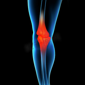 膝盖疼痛摄影照片_人类膝盖疼痛与骨骼腿的解剖
