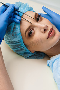 整形外科手术前面部眼睑成形术标记特写，用于在医疗诊所修改面部眼部区域