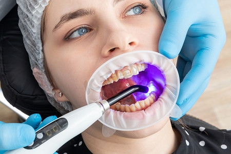牙医在患者牙齿上使用牙科固化紫外线灯的特写视图