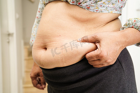 超重的亚洲女性用手挤压脂肪腹部大尺寸超重和肥胖。
