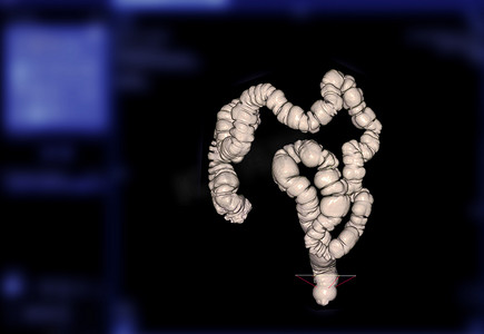 结肠 3D 渲染图像的 CT 结肠造影或 CT 扫描。