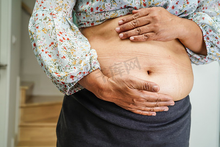 亚洲女性在办公室表现出肥胖的腹部大尺寸超重和肥胖。