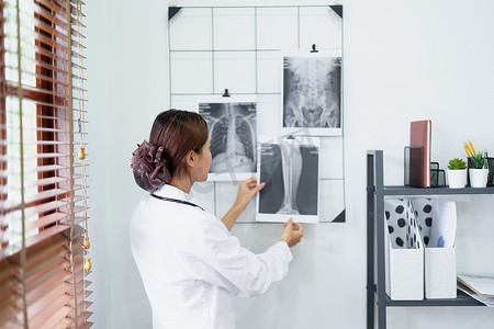 一位亚洲女医生在分析治疗症状前查看患者肺部 X 光片的肖像