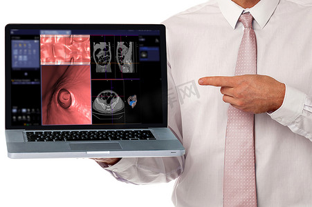 新型冠状病毒感染预防要点摄影照片_医生使用笔记本电脑显示 CT 结肠造影或结肠轴向视图 CT 扫描与冠状视图和屏幕上的 3D 渲染图像。