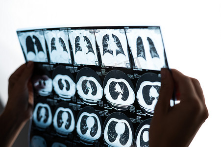 一位女医生检查内脏的核磁共振扫描。