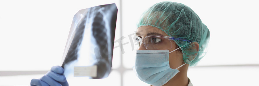 合格的女性医生检查患者肺部的 X 射线扫描
