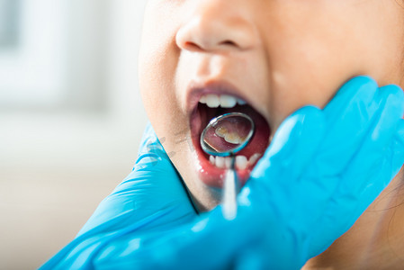 牙科邀请卡摄影照片_医生检查小孩口腔使用口镜检查牙腔