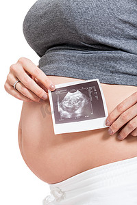 凸点摄影照片_显示产前超声检查的孕妇