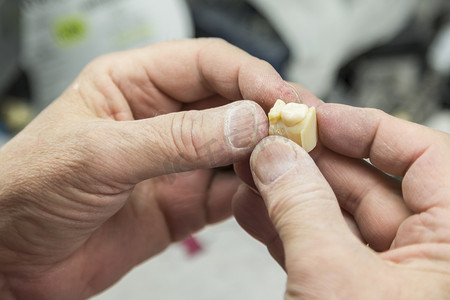 牙科技术员正在研究用于种植牙的 3D 打印模具