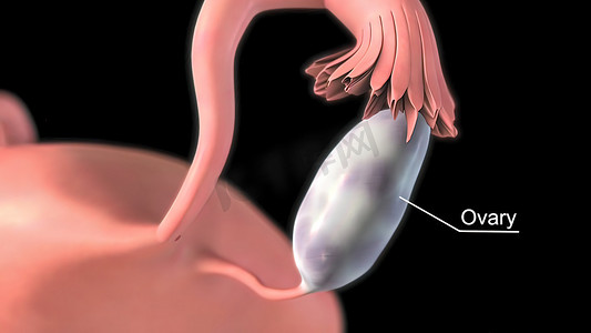 卵巢的联合生殖细胞-性腺间质-上皮肿瘤。