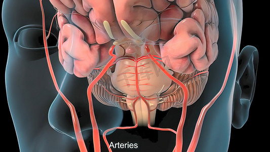 大脑血管 MRI 和脑血管疾病或出血性中风