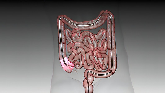 通过从肛门进入，用光纤照相机在监护仪下对大肠进行 Eamination