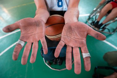 在竞技场上一场令人筋疲力尽的比赛后，残疾篮球运动员的手。