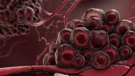 3D 插图激活的癌细胞，生长的肿瘤