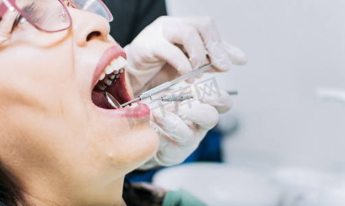 牙医检查病人的特写，牙医检查病人的嘴，牙医手检查病人嘴的特写，牙医进行口腔科