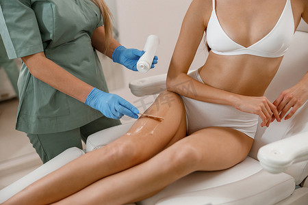 美容院激光脱毛手术前在客户腿上涂抹特殊药膏