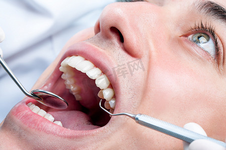 年轻人在牙医那里美白牙齿。