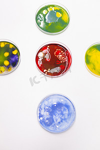 生物科学医院实验室桌子上的培养皿中细菌菌落的混合。