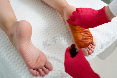 脚汗摄影照片_医生准备在女性足部注射肉毒杆菌素以治疗多汗症、多汗症