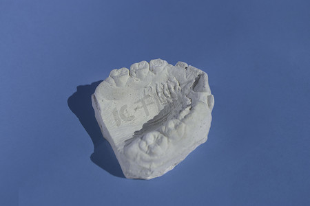 牙科石膏模型铸造口腔人颌
