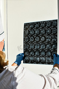 戴着防护手套的医生在医疗办公室进行脑核磁共振检查。