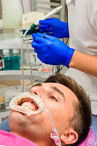 牙医的程序，牙医准备病人和工具，以去除病人嘴里的牙垢、唾液喷射器和牵引器。