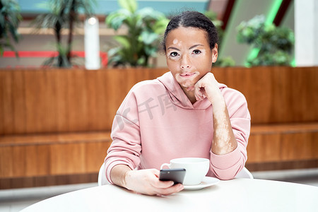 有白斑色素沉着皮肤问题的黑人非洲裔美国女性室内穿着粉红色连帽衫