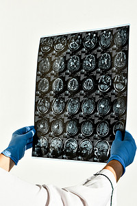 核磁共振摄影照片_戴着防护手套的医生在医疗办公室进行脑核磁共振检查。