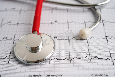 听诊器心电图心电图、心电波、心脏病发作、心电图报告。