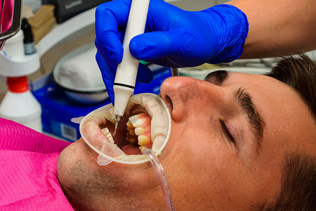 牵引摄影照片_牙科实践，牙医在超声波的帮助下去除牙齿上的结石和硬斑块，患者口腔内有牵引器和唾液喷射器。