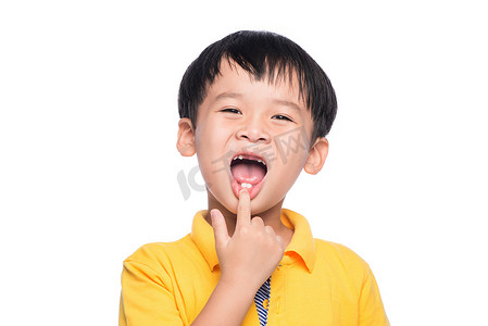 失去乳牙的亚洲男孩，特写视图。