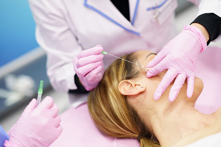 注射治疗摄影照片_医生将 PDO 缝合治疗线注射到一名妇女的脸上。