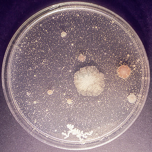 带培养基和霉菌的培养皿在实验室