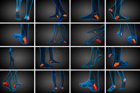 跟骨骨的 3d 渲染医学插图
