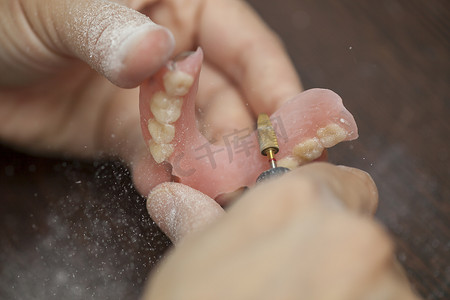 技术人员在牙科实验室制作假牙