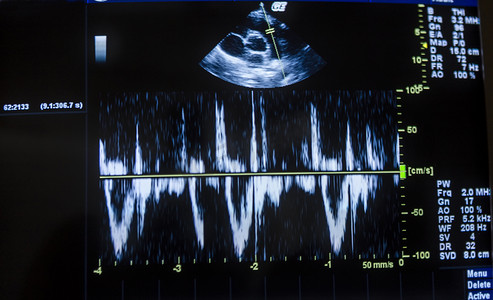 计算机屏幕上的心脏超声图像和心电图。