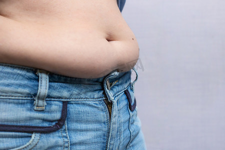 大肚子摄影照片_超重的女人，大肚子脂肪褶皱
