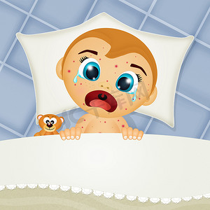 患有麻疹的婴儿哭闹