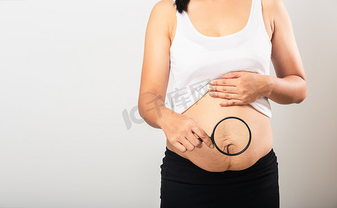 女人用放大镜显示妊娠纹松弛的下腹部